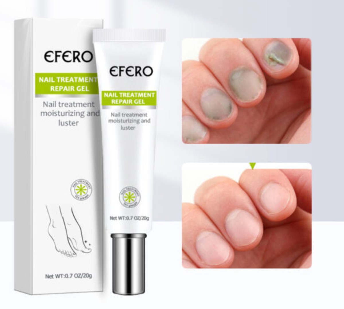 Nail Repair Gel Fungus Treatment Solution