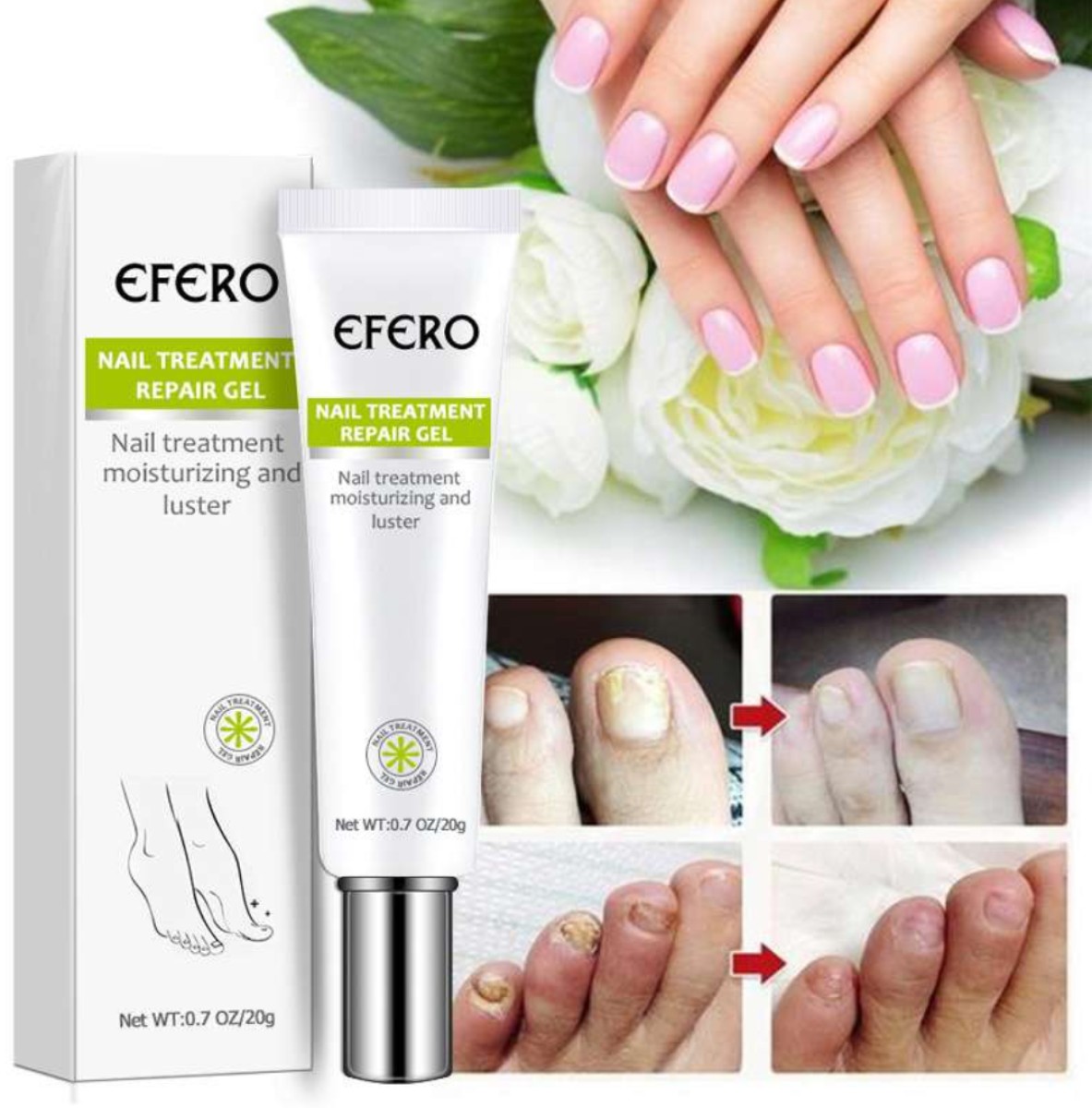 Nail Repair Gel Fungus Treatment Solution