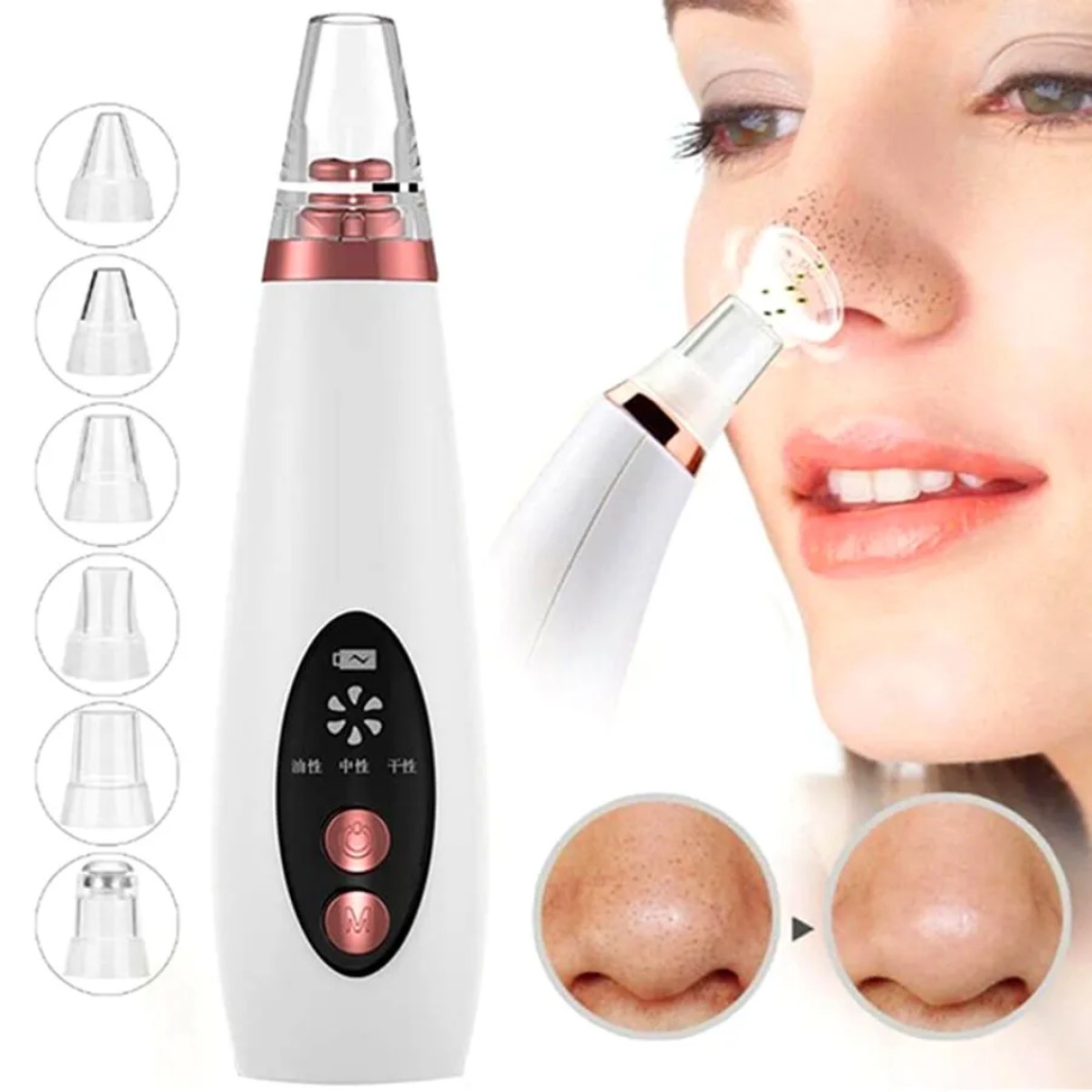 Blackhead Remover Extractor 6 Suction Head Beauty Machine For Skin Care